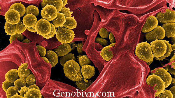 Staphylococcus Aureus