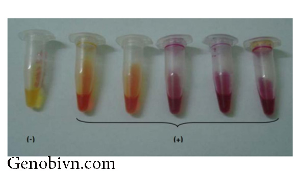 Urea Test Kit Khuan Hp