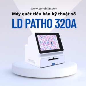 May Quet Tieu Ban Ky Thuat So Ld Patho 320a