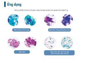 Infographic May Phet Te Bao Tu Dong Lts 3000a 2 Genobi