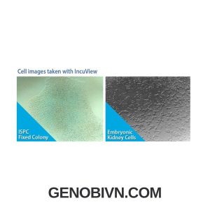 Tu Am Co2 Suretherm Voi Kinh Hien Vi Incuview Lci 1 Genobivn