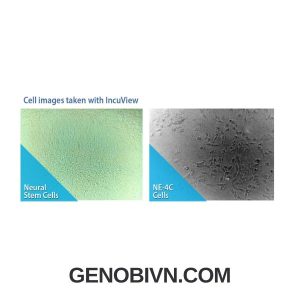 Tu Am Co2 Suretherm Voi Kinh Hien Vi Incuview Lci 2 Genobivn