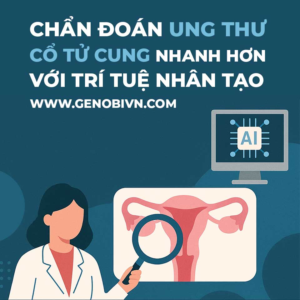 Genobi Chan Doan Ung Thu Co Tu Cung Thong Minh Hon Voi Tri Tue Nhan Tao