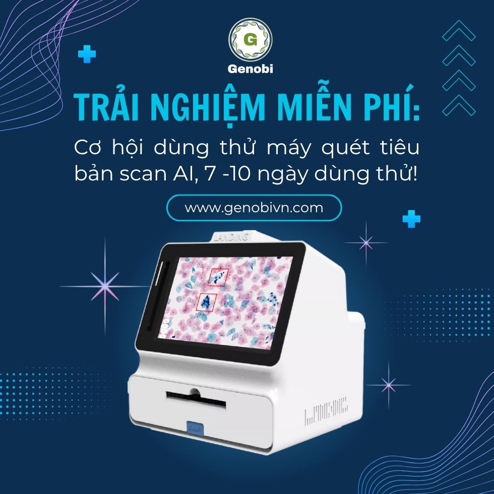 Genobi Trai Nghiem Mien Phi Co Hoi Dung Thu May Quet Tieu Ban Ky Thuat So