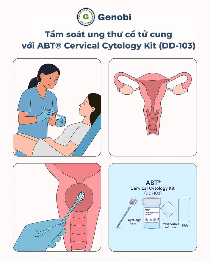 Abt Cervical Cytology Kit Dd 103 Thu Mau Co Tu Cung Hieu Qua Genobivn