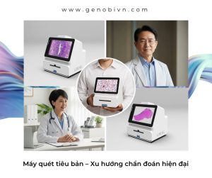 May Quet Tieu Ban Xu Huong Chan Doan Hien Dai Genobi