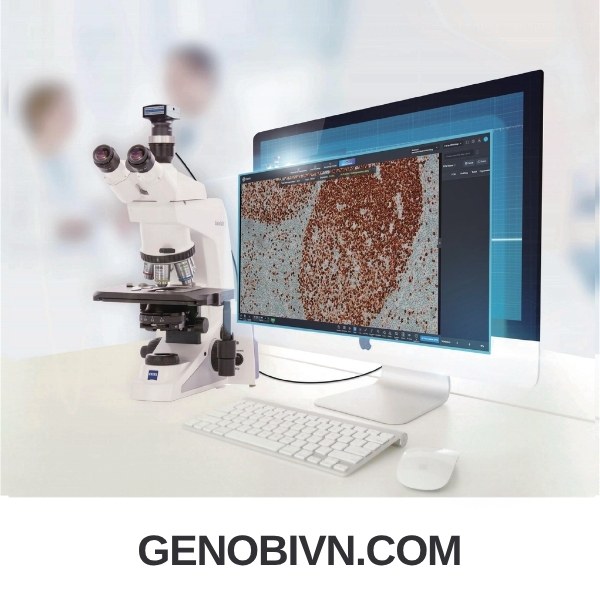 D Clevereye Nen Tang Chan Doan Giai Phau Benh Ho Tro Ai Va Hoi Chan Tu Xa Genobi