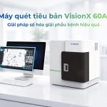 May Quet Tieu Ban Ky Thuat So Visionx 60a Ho Tro Giai Phau Benh So Hieu Qua Genobi