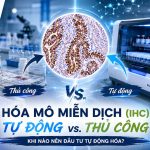 Hoa Mo Mien Dich Ihc Tu Dong Vs Thu Cong Khi Nao Nen Dau Tu Tu Dong Hoa Genobi
