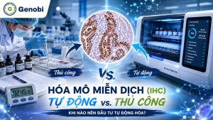 Hoa Mo Mien Dich Ihc Tu Dong Vs Thu Cong Khi Nao Nen Dau Tu Tu Dong Hoa Genobi