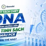 Kit Tach Chiet Dna Anh Huong Den Do Tinh Sach Mau Pcr Nhu The Nao Genobi