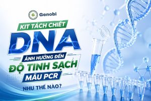 Kit Tach Chiet Dna Anh Huong Den Do Tinh Sach Mau Pcr Nhu The Nao Genobi