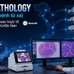 Telepathology Giai Phau Benh Tu Xa Mo Hinh Trien Khai Thuc Te Cho Benh Vien Tuyen Tinh Genobi