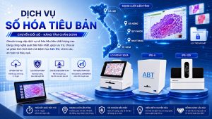 Dich Vu So Hoa Tieu Ban Tai Genobi