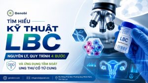 Tim Hieu Ky Thuat Lbc Nguyen Ly Quy Trinh 4 Buoc Va Ung Dung Tam Soat Ung Thu Co Tu Cung Genobi